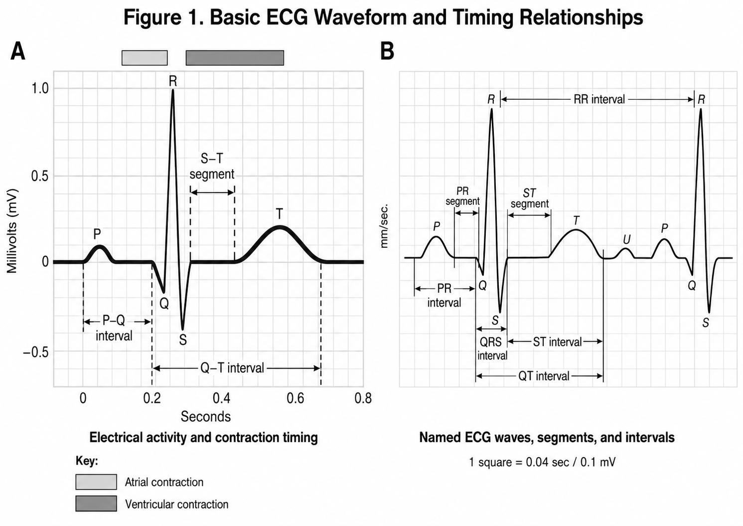 Two panels. A, a single ECG complex plotted as millivolts against seconds, labelling the P wave, Q, R and S deflections and the T wave, with the P–Q interval, the S–T segment and the Q–T interval marked, and a key showing the periods of atrial and ventricular contraction. B, a run of complexes labelling the named waves, segments and intervals: P, Q, R, S, T and U waves, the PR segment and PR interval, the QRS interval, the ST segment, the ST interval, the QT interval and the R–R interval between successive beats. One small square equals 0.04 seconds or 0.1 millivolts.