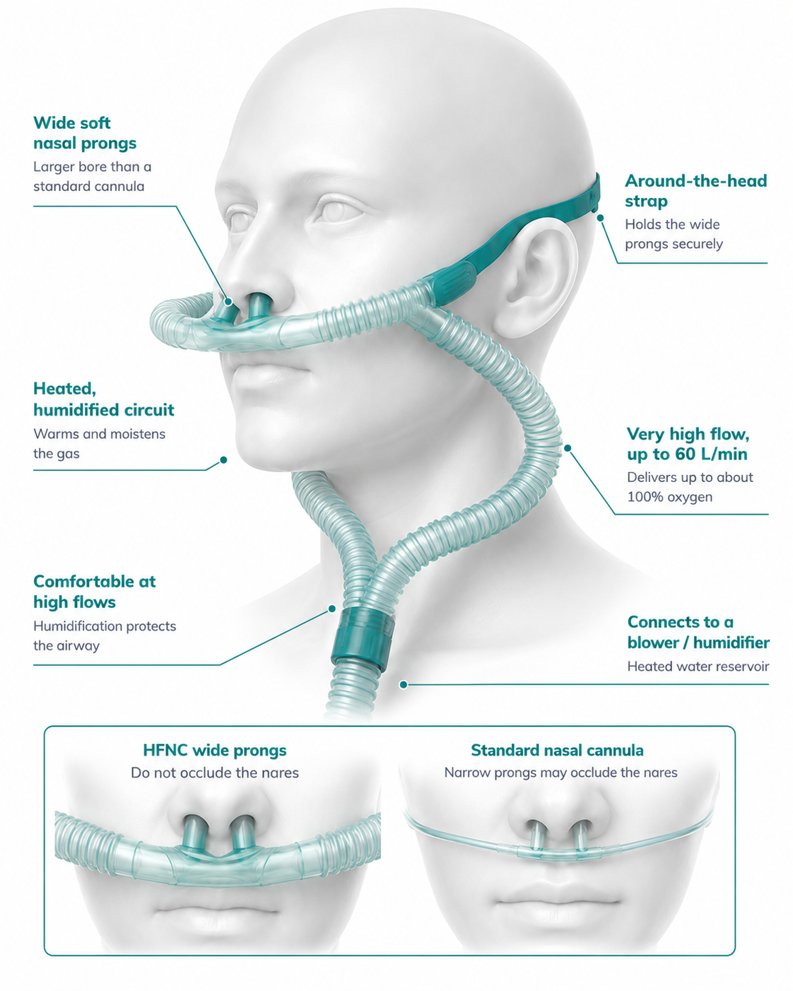 High-flow nasal cannula &mdash; wide-bore prongs, heated humidified circuit